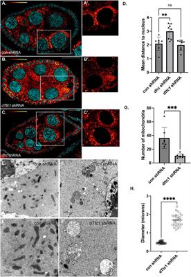 dTtc1, a conserved tetratricopeptide repeat protein, is required for maturation of Drosophila egg chambers via its role in stabilizing electron transport chain components